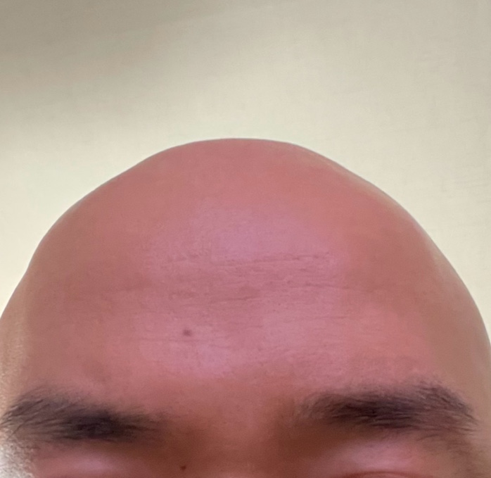 멀희