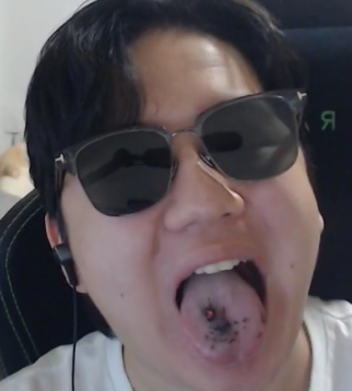 홍똥꼬